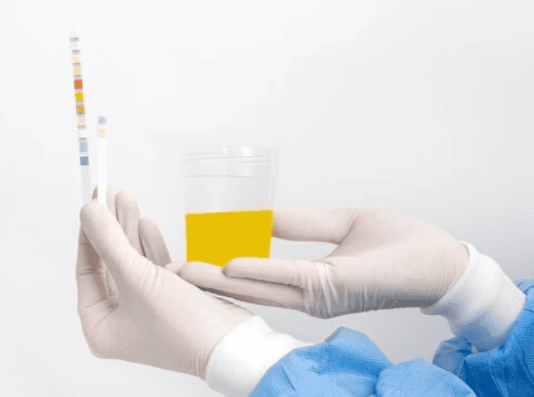 Testes Rápidos Laboratoriais